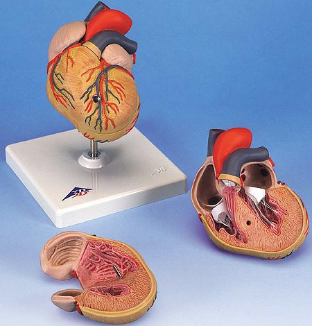 【送料無料】【無料健康相談 対象製品】3B社　心臓模型　心臓左心室肥大・2分解モデル (g04) 人体模型
