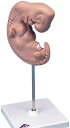 【送料無料】3B社　胎児模型　胎児25倍大モデル　（l15) 人体模型