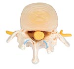Shop de clinic楽天市場店の【送料無料】【無料健康相談 対象製品】3B社　病理学模型　椎間板ヘルニアと変形性脊椎症モデル　（a795) 人体模型｜アングル3