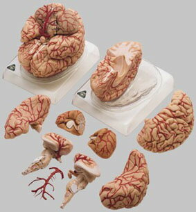 【送料無料】【無料健康相談 対象製品】ソムソ社 動脈付脳模型 bs23 人体模型