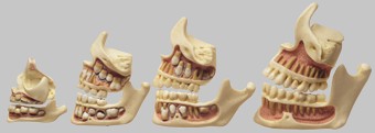 【送料無料】【無料健康相談 対象製品】ソムソ社 歯の発育模型 es14 人体模型