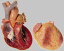 【送料無料】【無料健康相談 対象製品】ソムソ社 心臓模型 hs26 人体模型