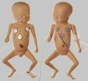 【送料無料】【無料健康相談 対象製品】ソムソ社 早産乳児（女児） ms61 人体模型