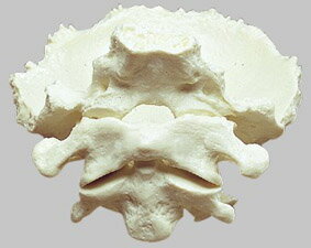 ソムソ社　第一頸椎と第二頸椎、後頭骨一部 qs57 人体模型