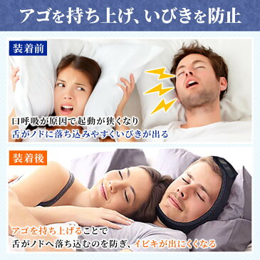 いびきサポーター いびき防止 いびき対策 グッズ サポーター 快眠 鼾 鼻呼吸 呼吸 風邪予防 睡眠改善 簡単 装着 矯正 サイズ調整 男女兼用 ノンセクシャル 2WAY メール便 送料無料