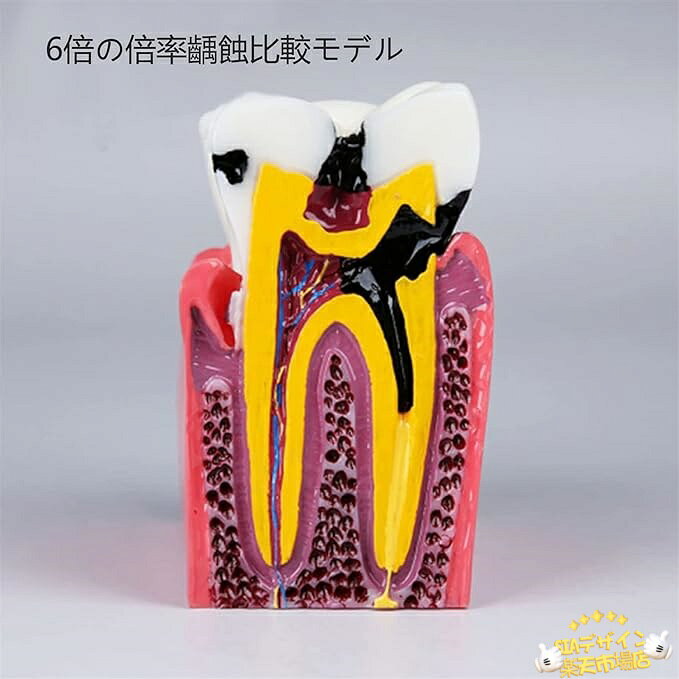 【全品2点で5%OFF】6倍の倍率歯 模型 歯...の紹介画像2
