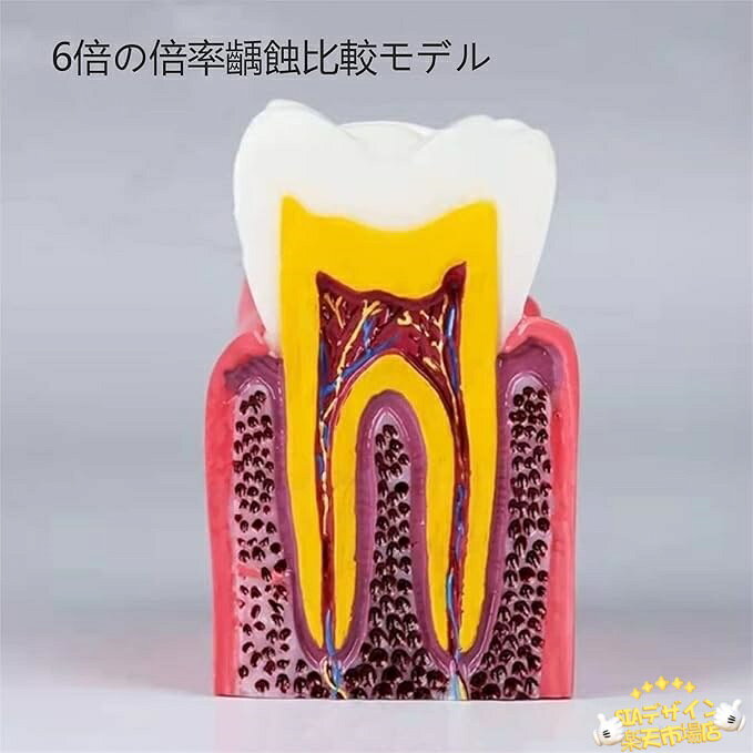 【全品2点で5%OFF】6倍の倍率歯 模型 歯...の紹介画像3