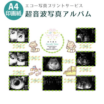 【送料無料】超音波写真アルバム [ことり] バリュー 赤ちゃんのエコー写真プリントサービス 男の子 女の子