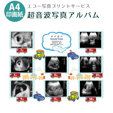 【送料無料】超音波写真アルバム [のりもの] バリュー 赤ちゃんのエコー写真プリントサービス 男の子