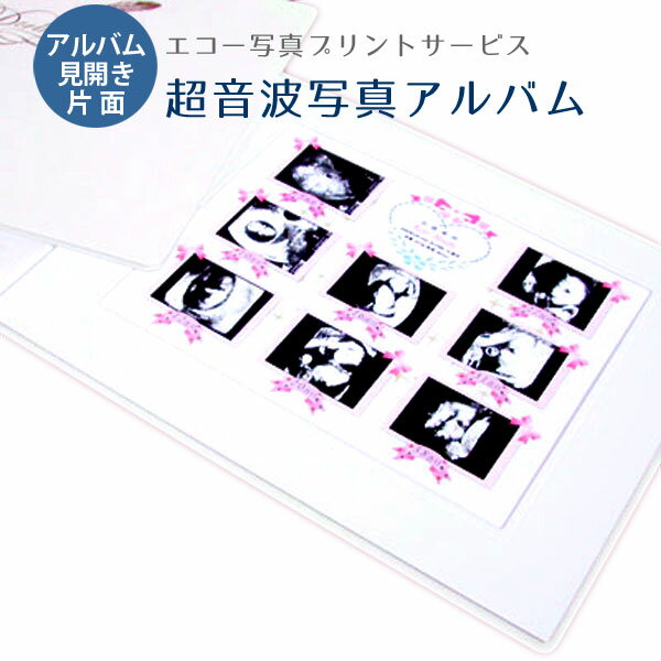 【送料無料】超音波写真アルバム ベーシック プリンセス 赤ちゃんのエコー写真オーダープリントサービス 女の子