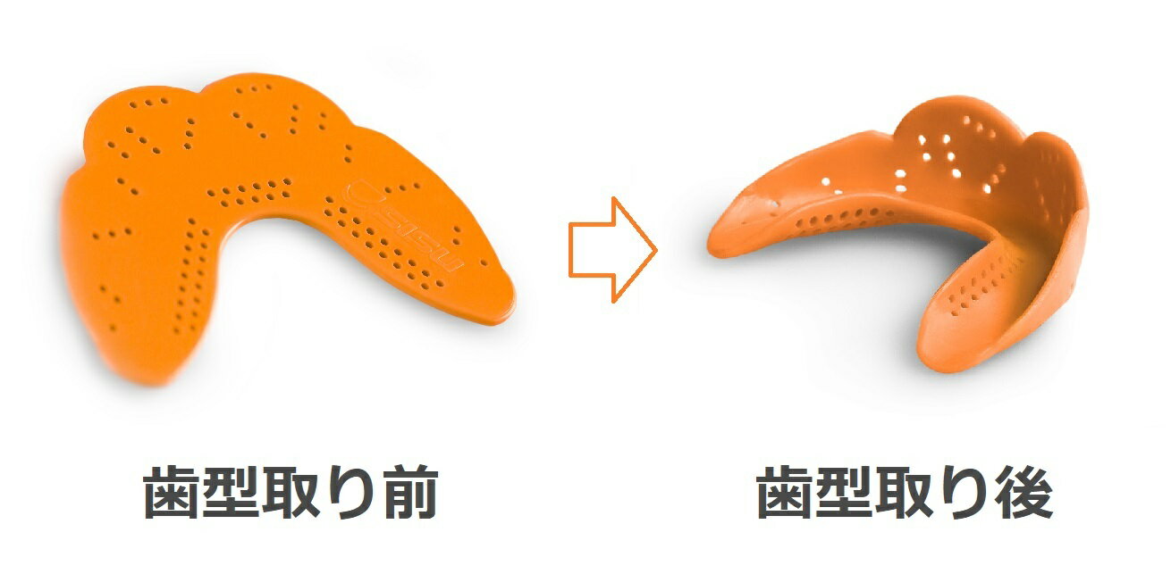 【防御力と快適さ】スポーツマウスピース SISU AERO MouthGuard S シス エアロ JUNIOR ジュニア マウスガード 米国製 1.6mm 10色 カスタムフィット 子供用 キッズ 小顔 サッカー 野球 バスケットボール 空手道 柔道 スキー 自転車 スノーボードセール サッカー 用品 セール