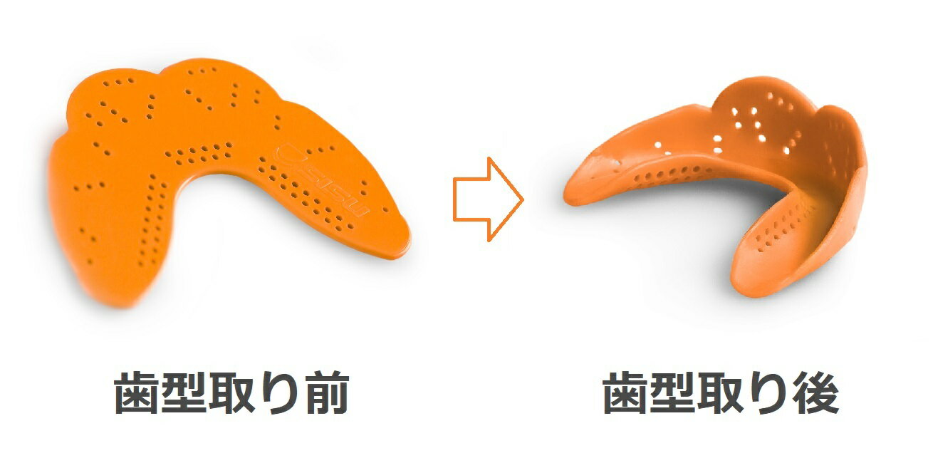 【防御力と快適さ】スポーツマウスピース　SISU AERO MouthGuard　S　シス　エアロ　JUNIOR　ジュニア　マウスガード　米国製　1.6mm　10色　カスタムフィット　子供用　キッズ　小顔　サッカー　野球　バスケットボール　空手道　柔道　スキー　自転車　スノーボード