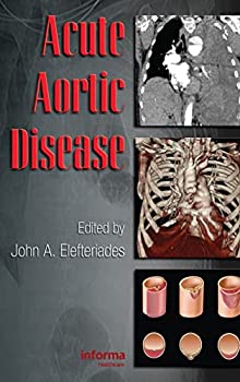 楽天スカイマーケットプラス【中古】【輸入品・未使用】Acute Aortic Disease （Fundamental and Clinical Cardiology）