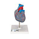 【中古】【輸入品・未使用】冠状血管と刺激伝導系をカラー表示した心臓模型 - 心臓,透明型・2分解モデル,刺激伝導系付 - 3B Scientific