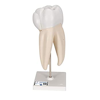 【中古】【輸入品・未使用】上顎大臼歯(3根)モデル,縦断3分解 - 3B Scientific 【中古】【輸入品・未使用】上顎大臼歯(3根)モデル,縦断3分解 - 3B Scientific