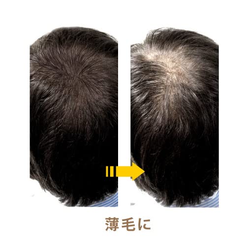 グリーンノートグリーンノート ヘアカラーファンデ ブラック