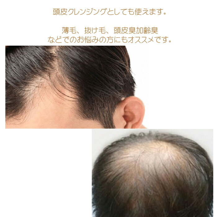 新発売 Morpho モルフォ/リフター＆ミネラリー モイスティングクレンジングソープ100ml/ヒト幹細胞/小顔/リフ（3枚目）