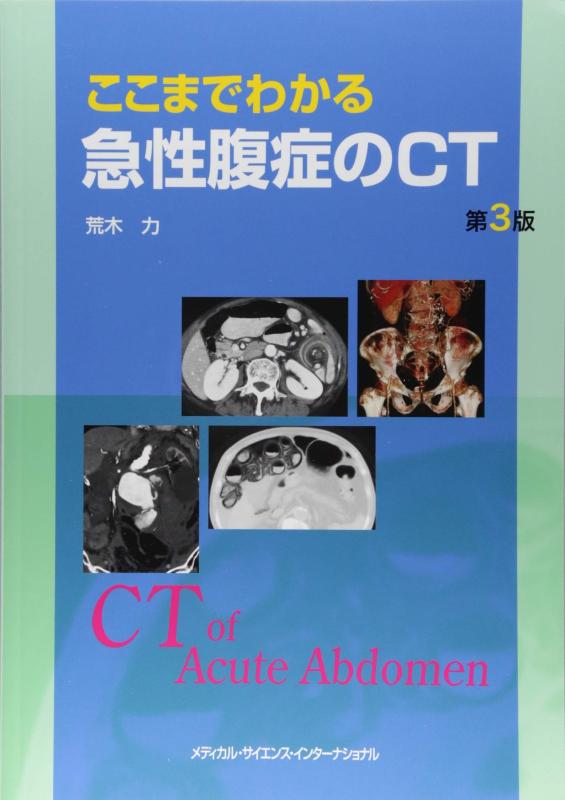 ここまでわかる急性腹症のCT 第3版