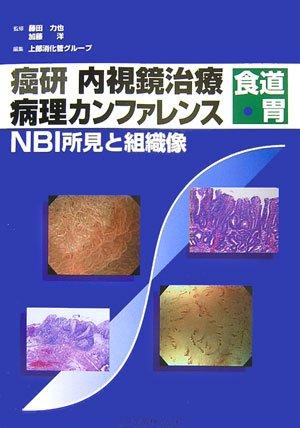 癌研内視鏡治療病理カンファレンス-食道・胃: NBI所見と組織像