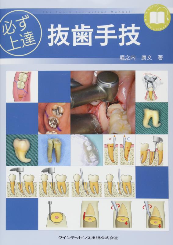 楽天市場】必ず上達 抜歯手技の通販