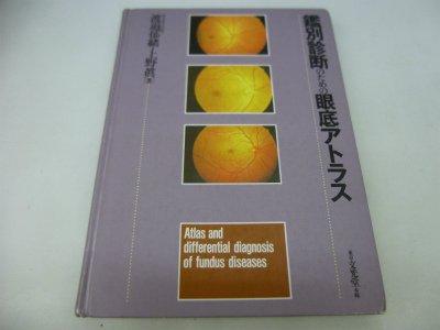 楽天市場】健診のための眼底検査の通販