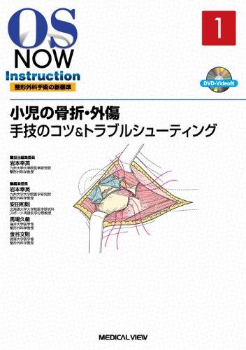 小児の骨折・外傷−手技のコツ&amp;トラブルシューティング  (OS Now Instruction)