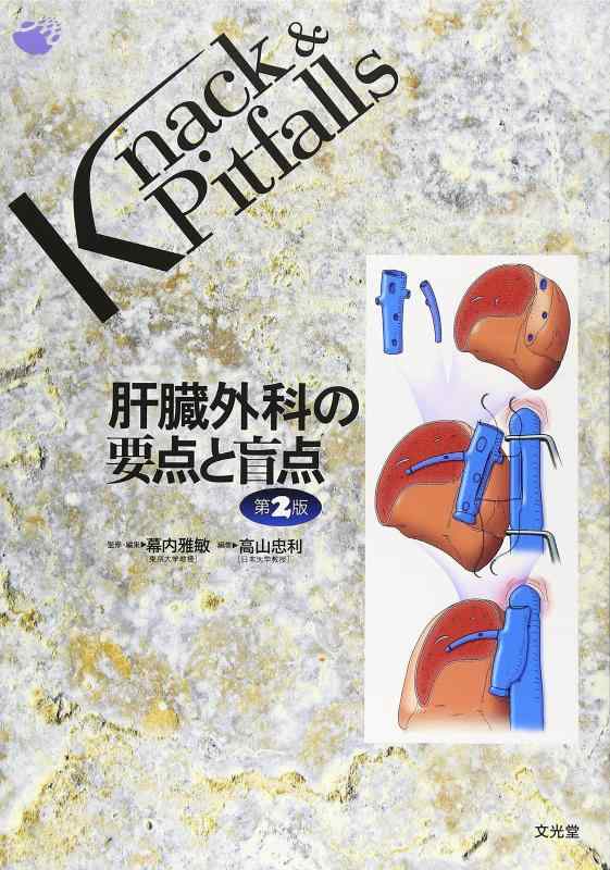 肝臓外科の要点と盲点 (Knack &amp; pitfalls)