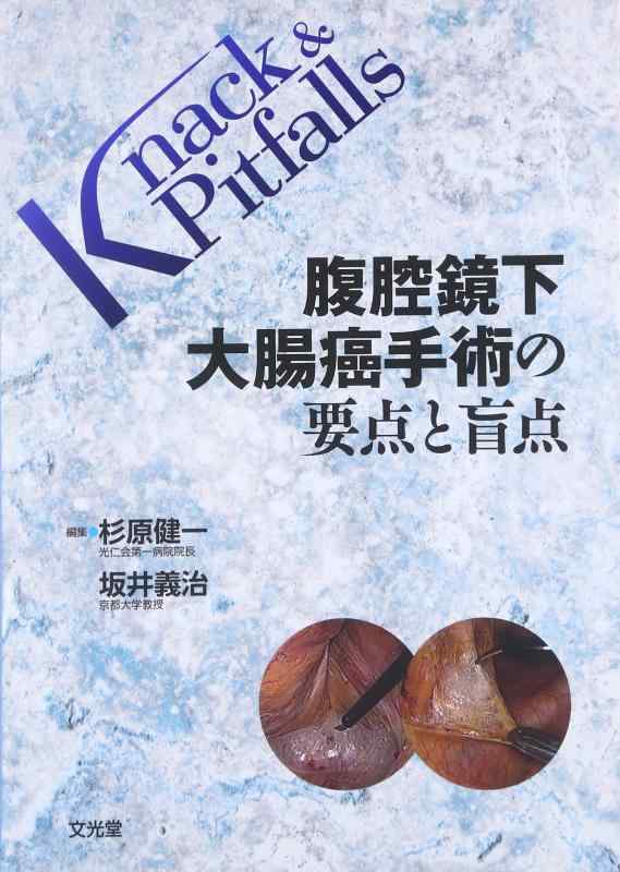 腹腔鏡下大腸癌手術の要点と盲点 (Knack &amp; pitfalls)