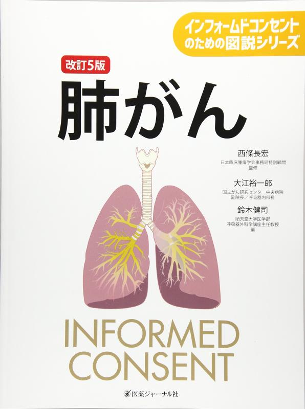 【中古】肺がん 改訂5版 (インフォームドコンセントのための図説シリーズ)