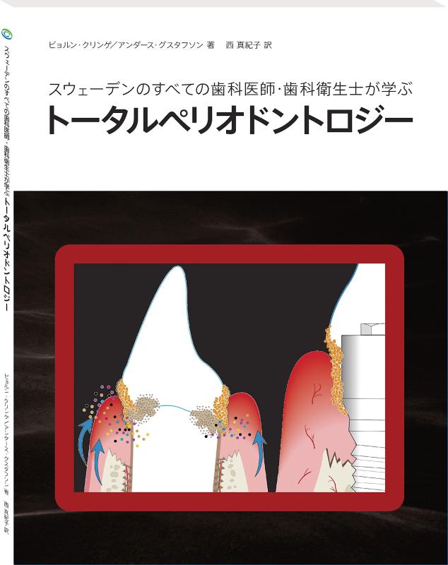 樂天商城 - 【中古】スウェーデンのすべての歯科医師・歯科衛生士が学ぶトータルペリオドントロジー