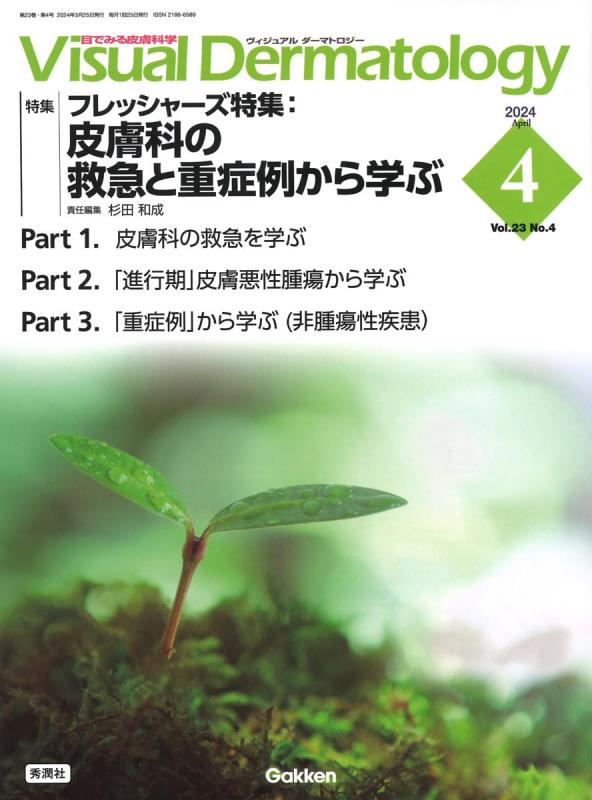 Visual D. 2024年4月号 Vol.23 No.4 (Visual Dermatology)