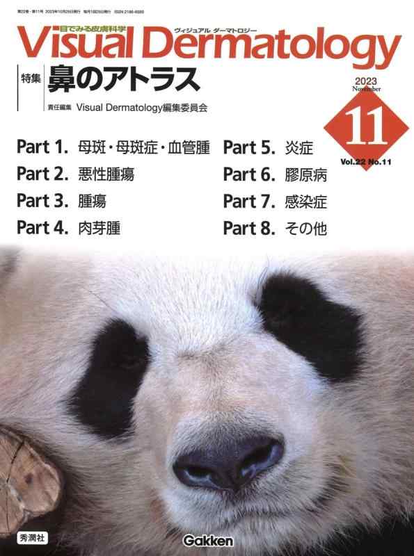 Visual D. 2023年11月号 Vol.22 No.11 (Visual Dermatology)