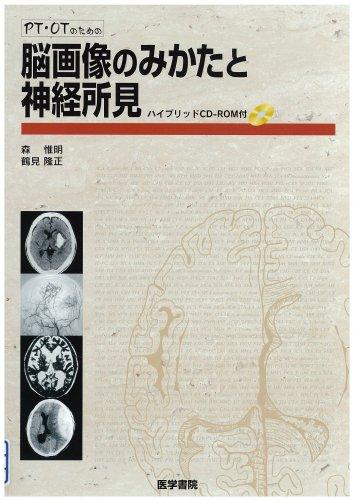PT/OTのための脳画像のみかたと神経所見■ ご購入前に必ずご確認ください ■1. 在庫管理とご注文の確定当店は複数のオンラインモールで在庫を共有しております。在庫の変動： 更新のタイムラグにより、ご注文後に「完売」が判明する場合がございます。欠品時の対応： 万が一商品が確保できない場合は、速やかにメールでご連絡の上、ご注文をキャンセル（全額返金）させていただきます。2. 中古商品のコンディション（動作確認済み）一点ごとに状態が異なるため、お届けする現品が掲載画像と細部まで一致しない場合がございます。状態の目安： 動作に支障のない範囲での微細なキズ・汚れ・日焼け・使用感は、中古品の特性としてあらかじめご了承ください。検品方針： 外観の美しさよりも「正常な動作」を最優先に検品・清掃を行っております。3. 付属品の同梱内容「本体の動作」を優先したセット内容となっております。【同梱あり】 本体の起動・動作に不可欠な基本パーツ（電源コード等）【同梱なし】 外箱・取扱説明書・セットアップ用CD・初回限定特典【保証対象外】 封入されているダウンロードコード・シリアル番号※商品名に「特典付」等の記載がある場合でも、中古品のため欠品している場合がございます。正確な内容を確認したい場合は、必ずご購入前にお問い合わせください。4. 初期不良のサポート（到着から3日間）商品がお手元に届きましたら、なるべく早めに動作をご確認ください。連絡方法： 商品到着から3日以内に、購入履歴の「ショップへ問い合わせ」より不具合の内容をご連絡ください。対応： 在庫がある場合は「良品交換」、在庫がない一点物の場合は「返品・全額返金」にて対応させていただきます