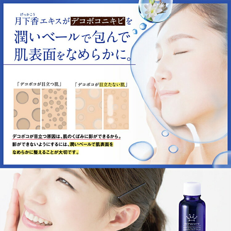 楽天市場 ニキビ ケア 化粧水 ニキビ跡 消し クレーター 薬用アクレケア 3本セット 医薬部外品 総健美舎
