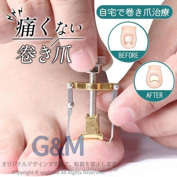 商品詳細:カラー:/シルバーサイズ:/フリーサイズ■商品説明・痛くない自分でできる・加工不要の新しい巻き爪・陥入爪の矯正治療・折り曲げ・接着などの加工がなく耐久性あり■素材ステンレス製■注意事項※巻き爪の程度がひどい場合には使用できません。※爪水虫等の爪の疾患や爪周辺に出血・化膿・炎症などの異常がある方は、治療を優先し、完治後にご使用下さい。※過去に金属アレルギー症状が現れた方や不安な方、その他本品の使用中に異常を感じた場合は、直ちに使用を中止するか医師にご相談ください。※事前に爪割れやヒビの有無をしっかり観察され、爪割れがあった場合は爪全体を伸ばしてからカットし、爪割れやヒビの無い状態でご使用下さい。