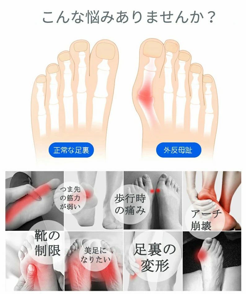 内反小趾 サポーター シリコンパッド 足底筋膜炎 薄型 夏用 衝撃吸収 足の痛み 立...