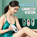 VIO対応 腕 脇 ヒゲ フェイス 顔 美肌機能 全身ケア ディスプレイ表示 冷感脱毛無痛脱毛 脱毛器 家庭用IPL光脱毛器