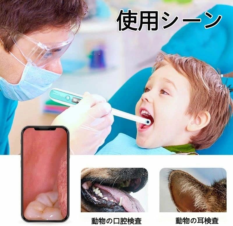 口腔内カメラ 可視カメラ 口腔 歯科 口腔内視鏡 歯科検診 歯の健康 口腔ケア用品 口腔内カメラ ワイヤレス画像伝送
