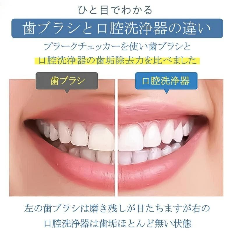 口腔洗浄器 歯垢除去 ジェットウォッシャー コードレス口腔洗浄機 コンパクト ジェ...