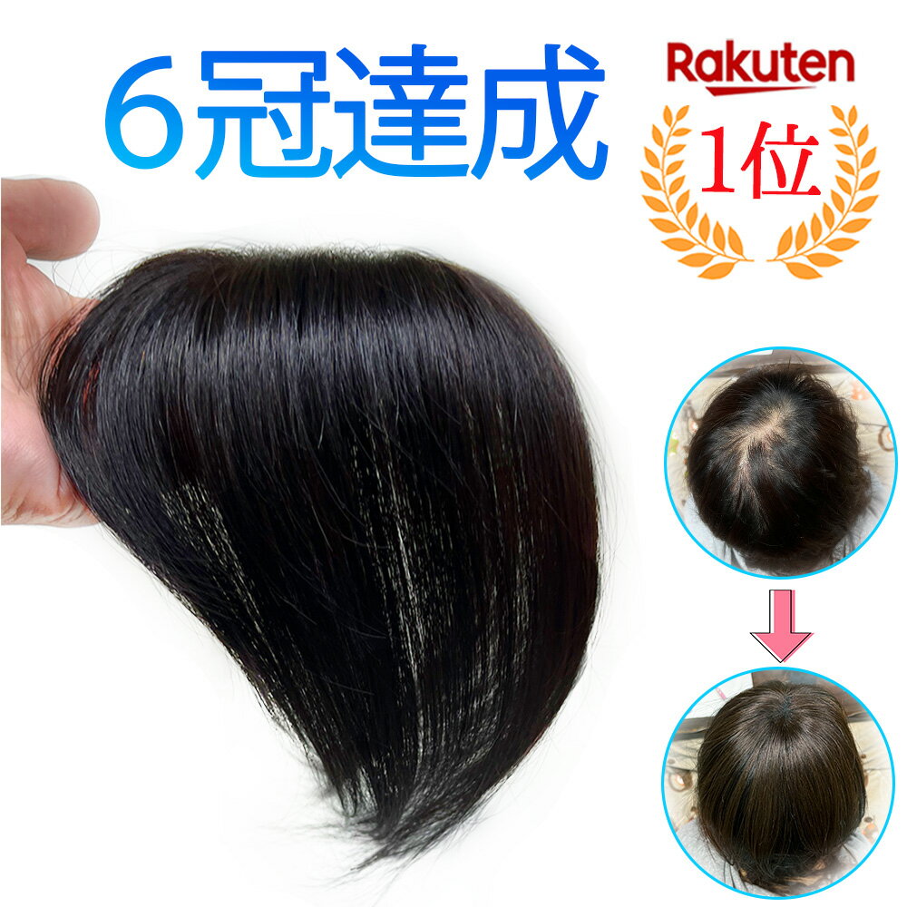 【楽天1位】 頭頂部 薄毛隠し 部分ウィッグ 【返品無料】 部分かつら 人毛 手織り 女性用 薄毛 隠す 部分ウイッグ ヘアピース ウイッグ 医療用 自然 バレない レディース トップカバー ナチュラル 白髪隠し 分け目 つむじ 送料無料