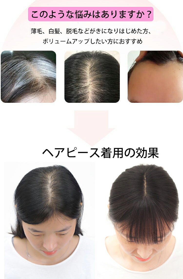 【期間限定：1点1,602円！クーポン利用で！】堂々の1位！ トップカバー 前髪ウィッ...