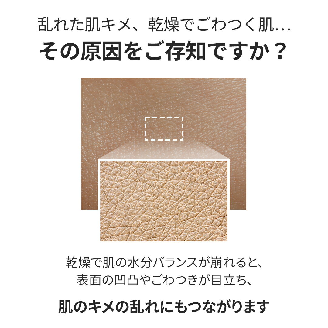 �� ��ʬ���ǥ����� ���� �ۡ� ���åץ�ԡ��� ������������ �������󥰥���ץ� 30ml �� ���Ʊ� �� �ĥ� Ʃ���� �Ҵ� �ݼ� ���� ���뤪�� �ϥ� ���� �ӷ� �Ѽ� ȩ���� ����ʡ��ɥ饤 ���륽����� ��餮ȩ ��ɷ� ��� ������ �����󥱥� �ڹ� ������ SUNGBOON EDITOR