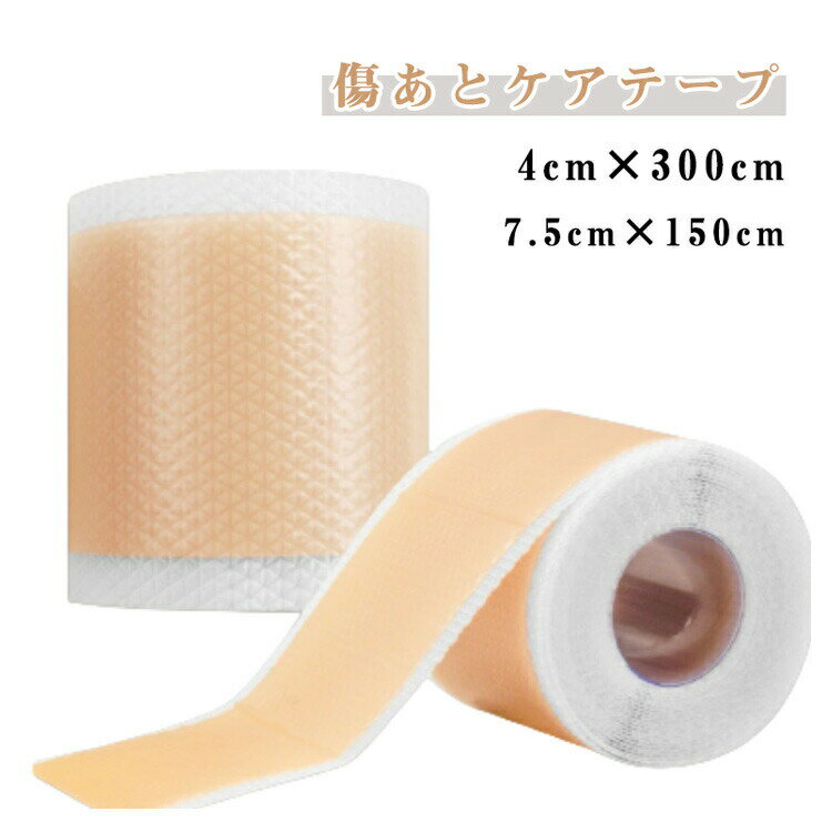 傷あとケアテープ 帝王切開 傷跡ケア シリコンジェルシート 伸展刺激抑制 摩擦軽減 紫外線予防 保護テープ 4cm×150cm 4cm×300cm 7.5cm×...