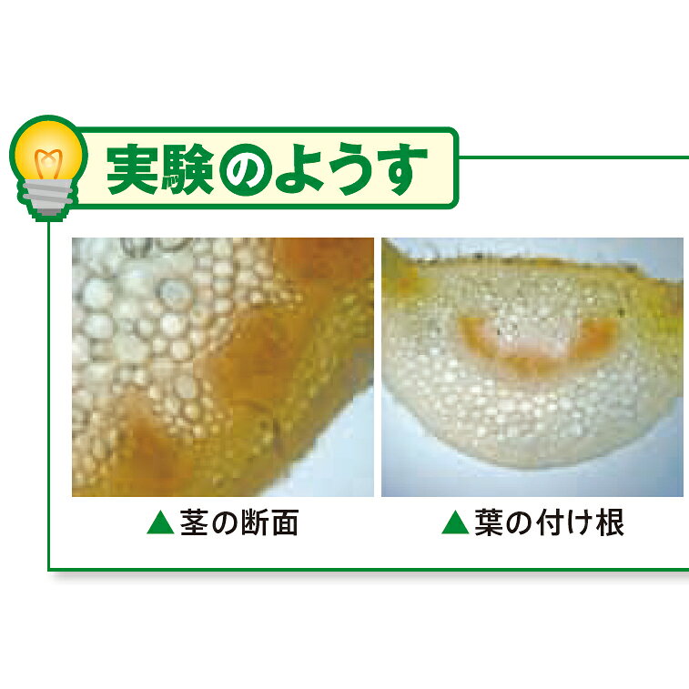 植物の道管 観察セット P-10N ケース付