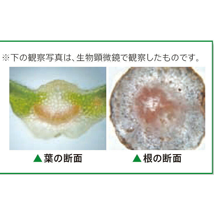 植物の道管 観察セット P-10N ケース付