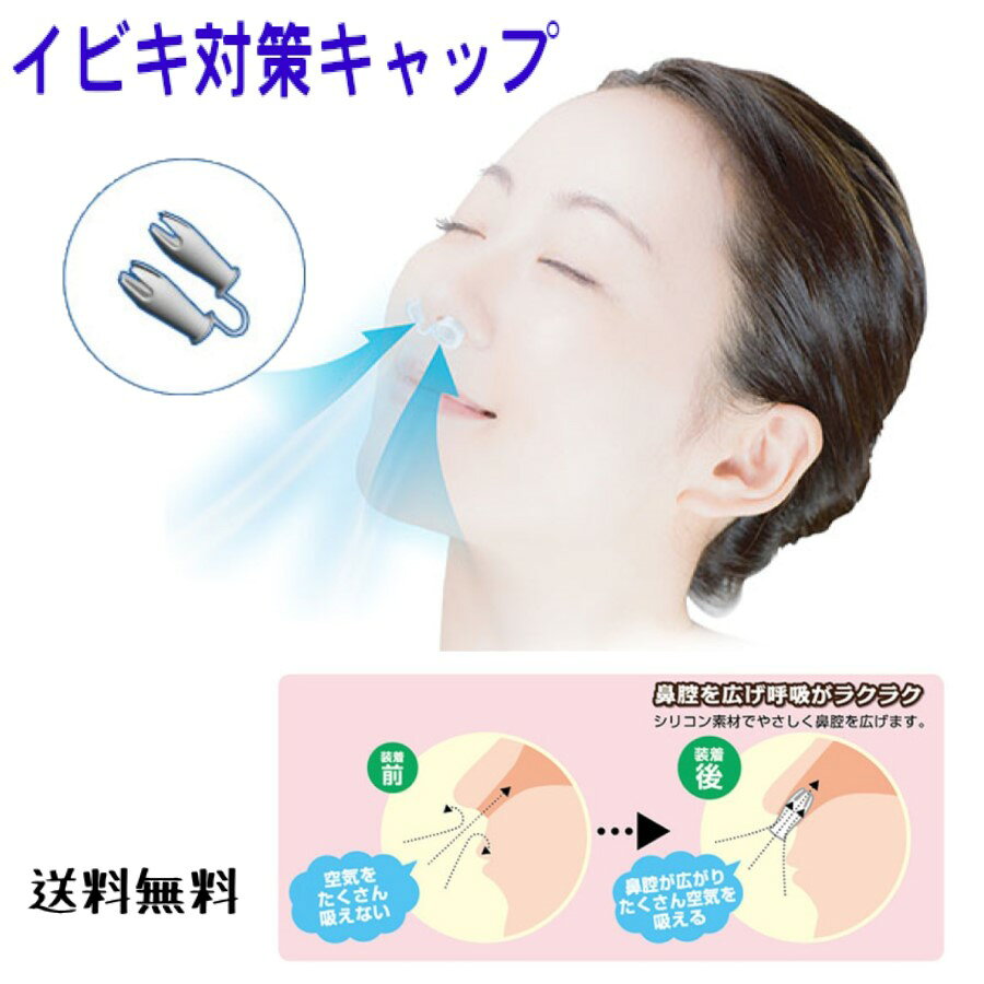 【追跡可能メール便で安心、スピード発送】シリコン素材 やさしく鼻腔を広げる 『 イビキ対策キャップ 』 いびき 鼻呼吸 サポート 水洗い可能 奥に入り込まない ガード付き 痛くない 鼻に入れるだけ お悩み