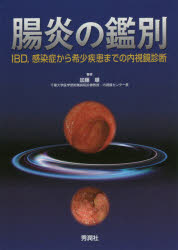 【送料無料】腸炎の鑑別　IBD，感染症から希少疾患までの内視鏡診断／加藤順／著