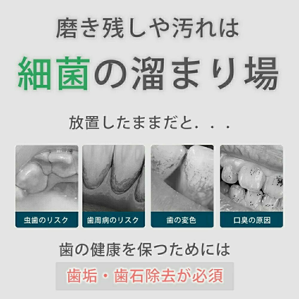 歯石取り 家庭用歯石取りセット 口腔洗浄器 超音波 スケーラー 歯石 除去 超音波 ...
