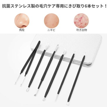 ニã‚ビå–り - Luxspire ニã‚ビ ケア 毛抜ã è§’æ “å–り 6本セット 角質・黒ãšã¿å–り æ¯›ç©´ã‚±ã‚¢è£½å“ ãƒ•ã‚§ãƒ¼ã‚¹ã‚±ã‚¢ ステンレス製 æŠ—èŒ å®‰å…¨ スティック æ½°ã—専用 毛穴ケア専用ã‚ット é¢çš°åœ§å‡ºå™¨ 美容ツール ã™ã£ãり毛穴ケア セット