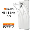 Xiaomi Mi 11 Lite 5G ソフトケース カバー TPU クリア ケース 透明 無地 シンプル 全面 クリア 衝撃 吸収 指紋防止 薄型 軽量 シャオミ ミー イレブン ライト SIMフリー シャオミー スマホケース 密着痕を防ぐマイクロドット加工